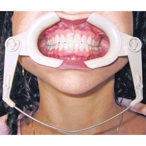 High Heat Cheek Retractor